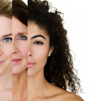 Types de peau