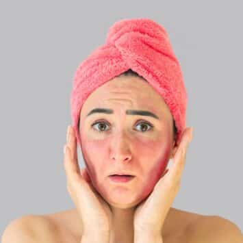 Après-soleil ou anti-irritation