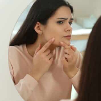 Qu'est-ce que l'acné hormonale ?