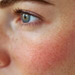 Rougeur visage remède de grand-mère