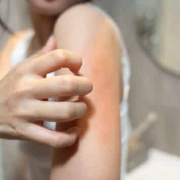 Aide à protéger la peau des agressions extérieures